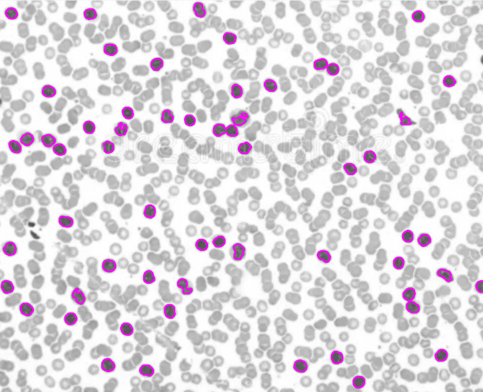 Catheter Path Finding
